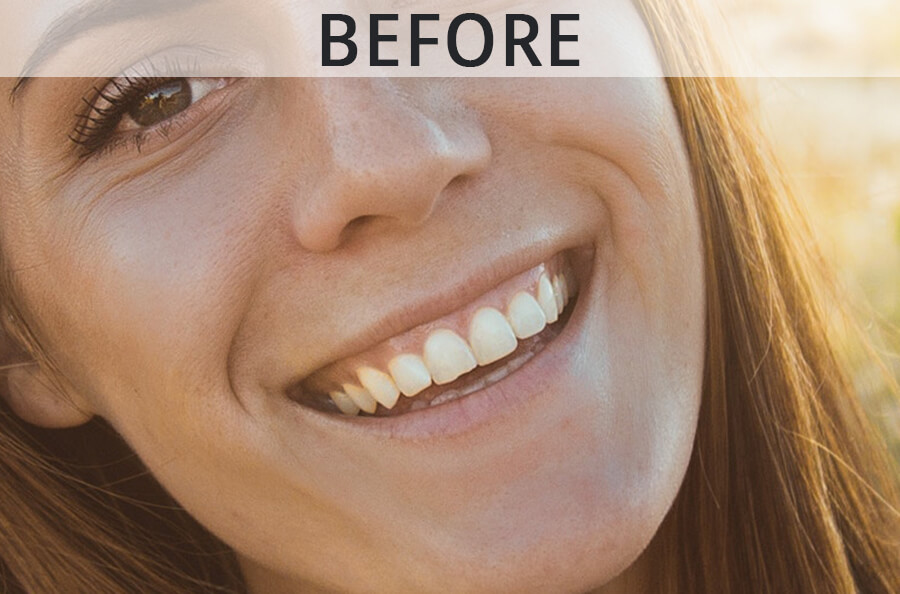 How to Whiten Teeth in Lightroom in 3 Steps (+FREE Brushes)