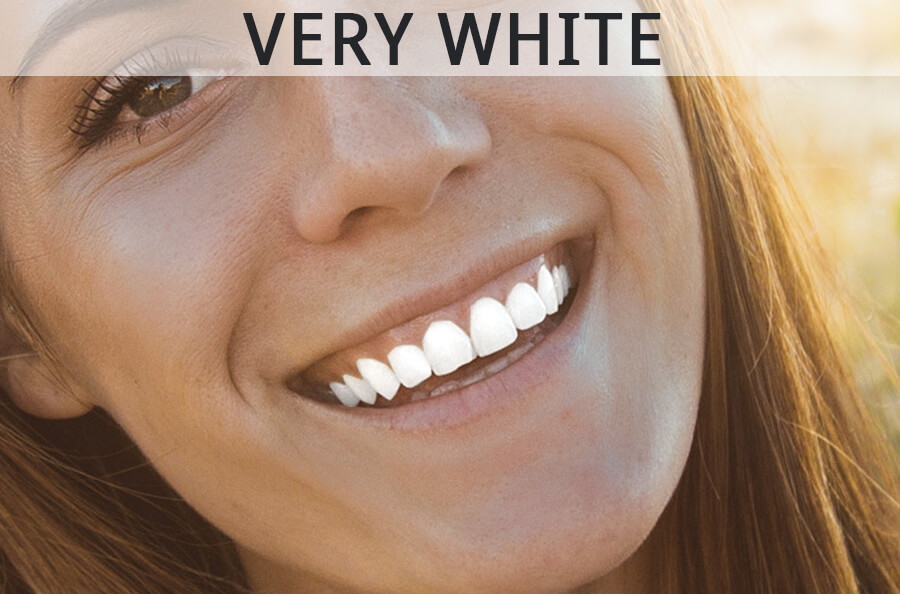 too white teeth