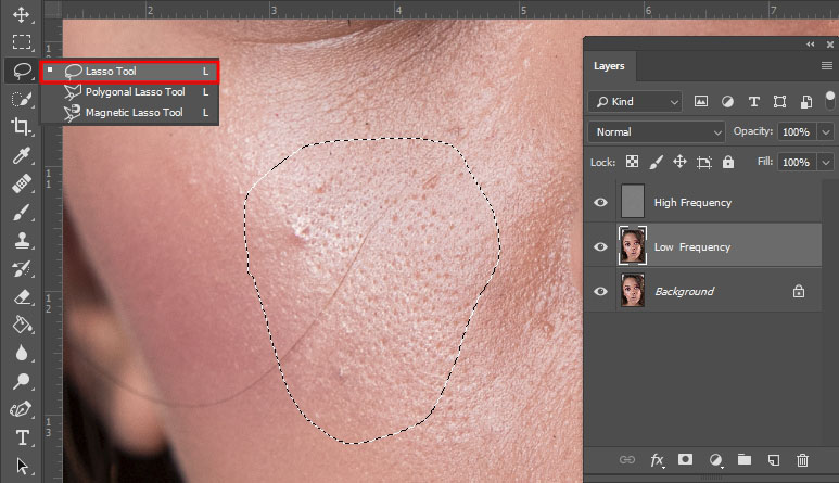 improve the skin with lasso tool