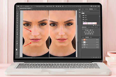 Plastic Surgery in Photoshop: Is It Worth Using