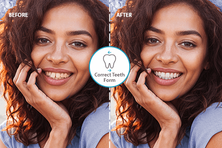 Rendi i denti dritti in 1 clic