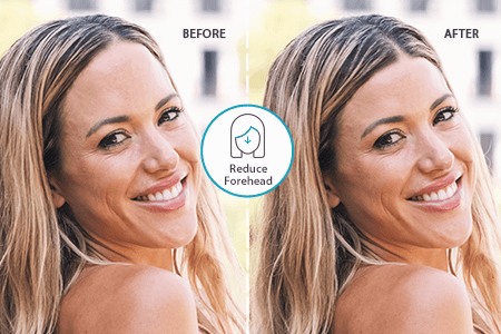 Reducir la frente en 1 clic