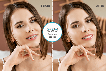 Uklonite aplikaciju Braces za Android i iOS