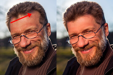 Che các đốm hói bằng tóc chỉ trong 1 cú nhấp chuột