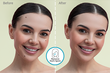 Uklonite tamne mrlje u 1 klik