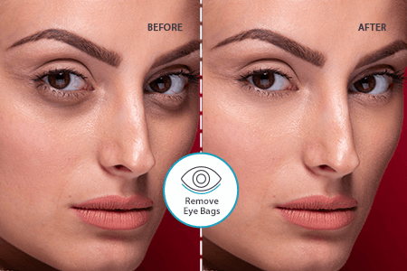 Uklonite vrećice ispod očiju u 1 klik