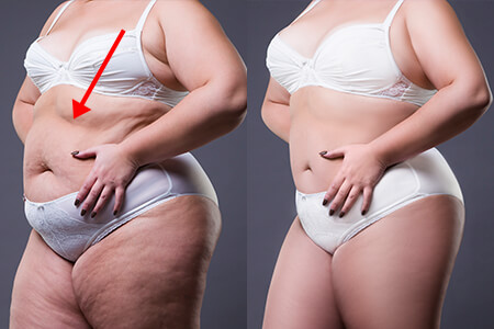 Haz que tu cuerpo y cintura se vean delgados en 1 clic