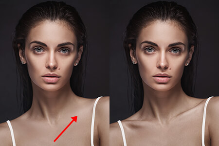 Jelölje ki a kulcscsontokat 1 kattintással