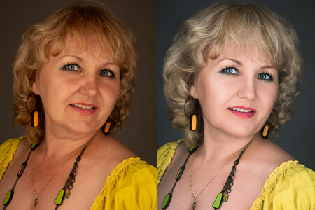 Photo Blemish Remover trực tuyến miễn phí