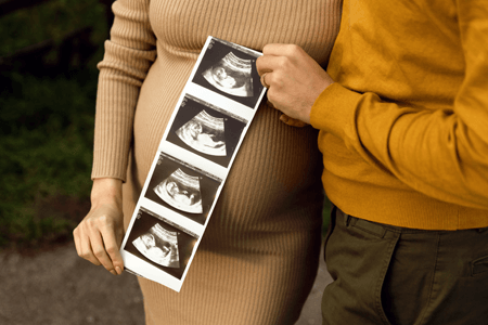 25 Best Pregnancy Announcement Ideas [Tips from an Expert]