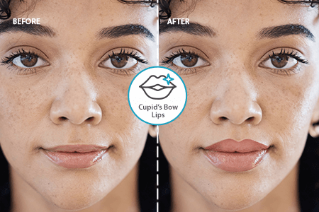 Cupid’s Bow Lips Editor [FREE]