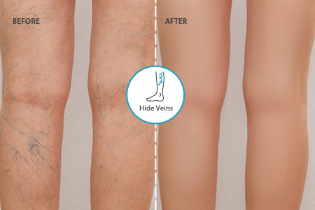 Hide Veins in Photo Online [FREE]