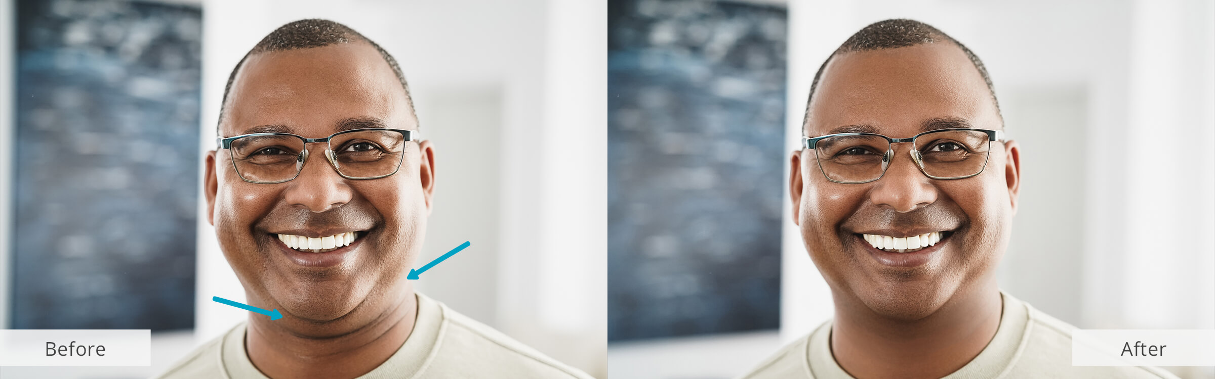 app to get rid of double chin in photos