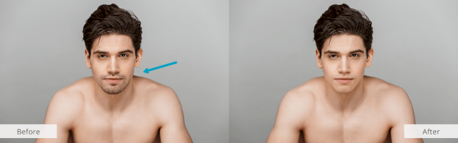 Beard Removal App for iOS and Android