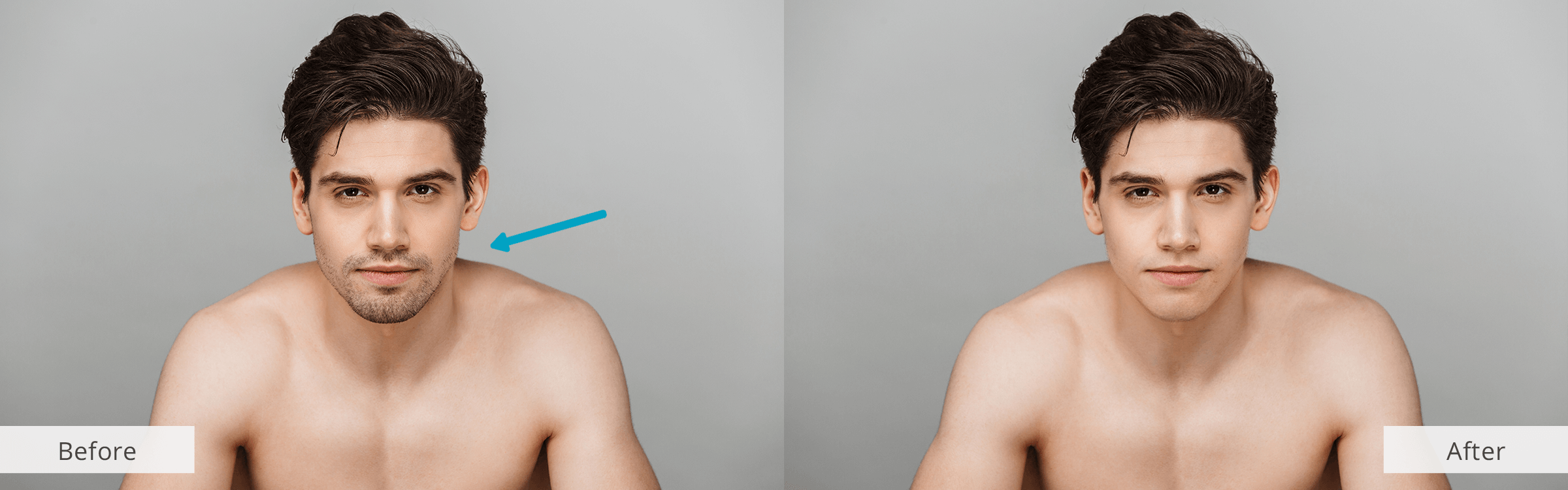 Beard Removal App for iOS and Android