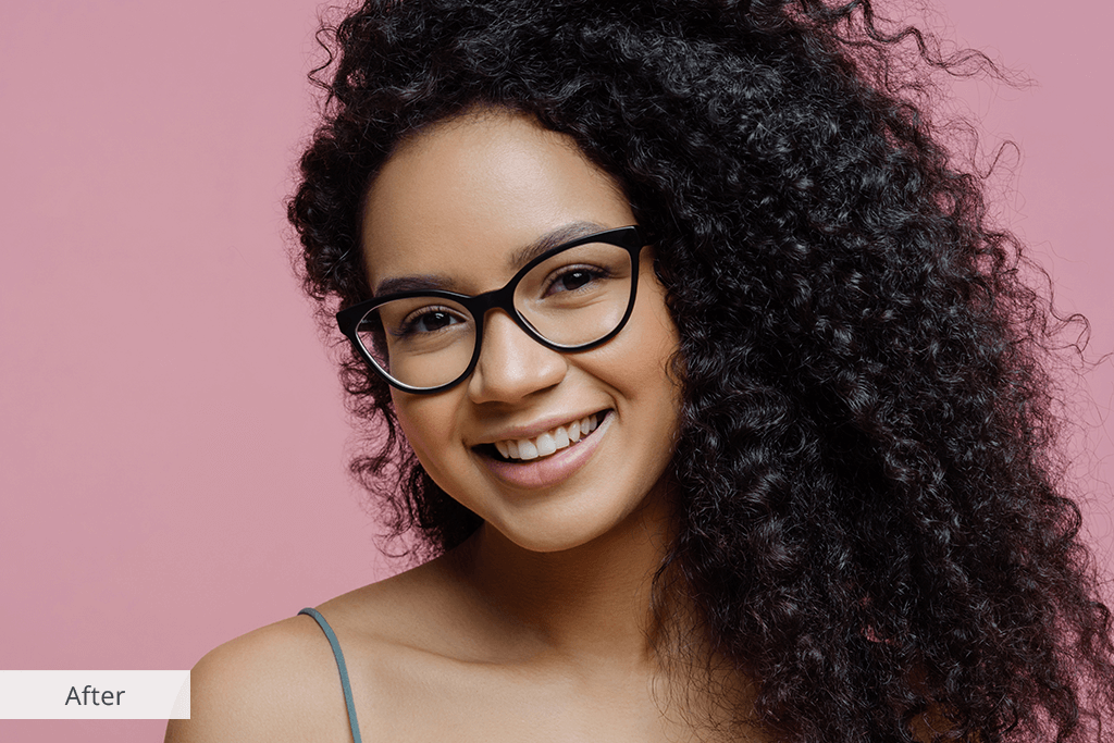 Dark Spot Remover App for Android and iOS from Fixthephoto