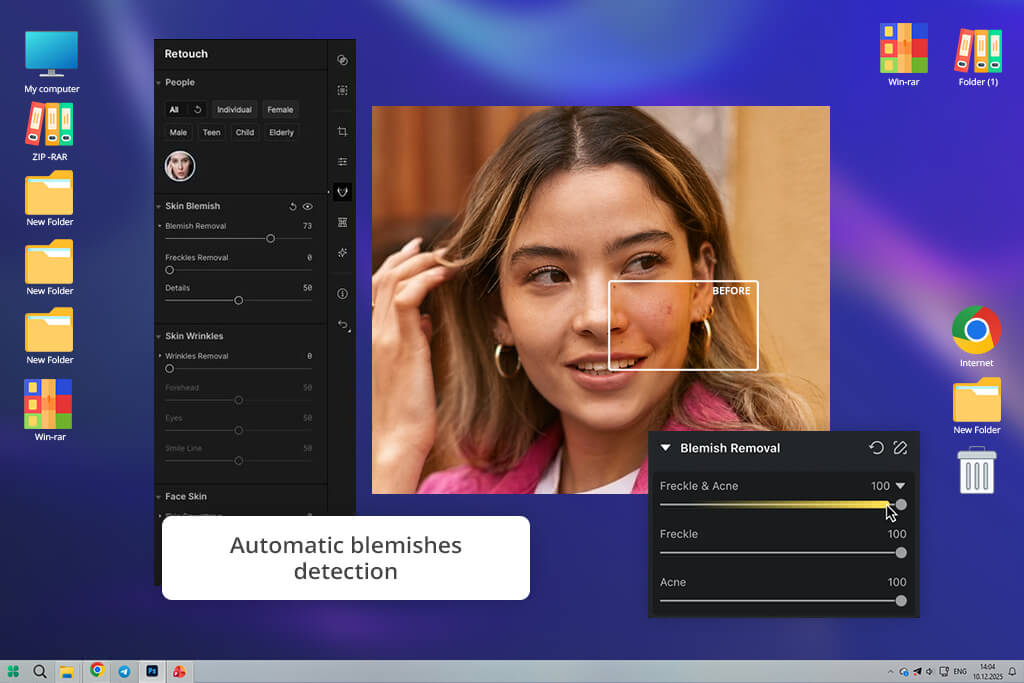aperty review blemish detection