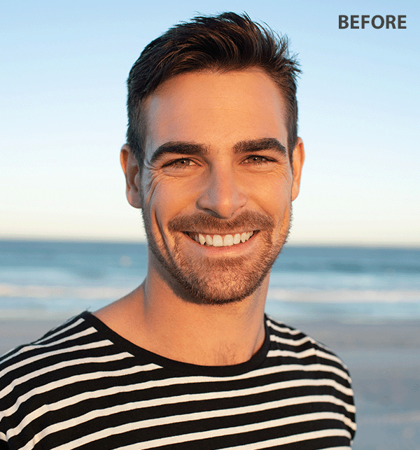 app that removes facial hair