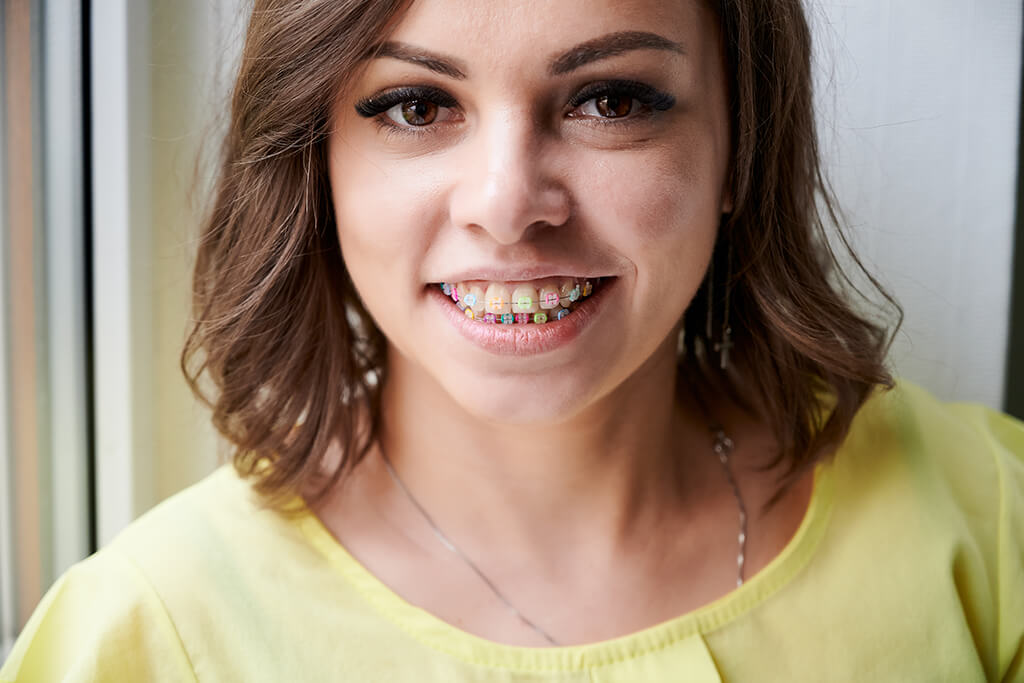 app that takes your braces off