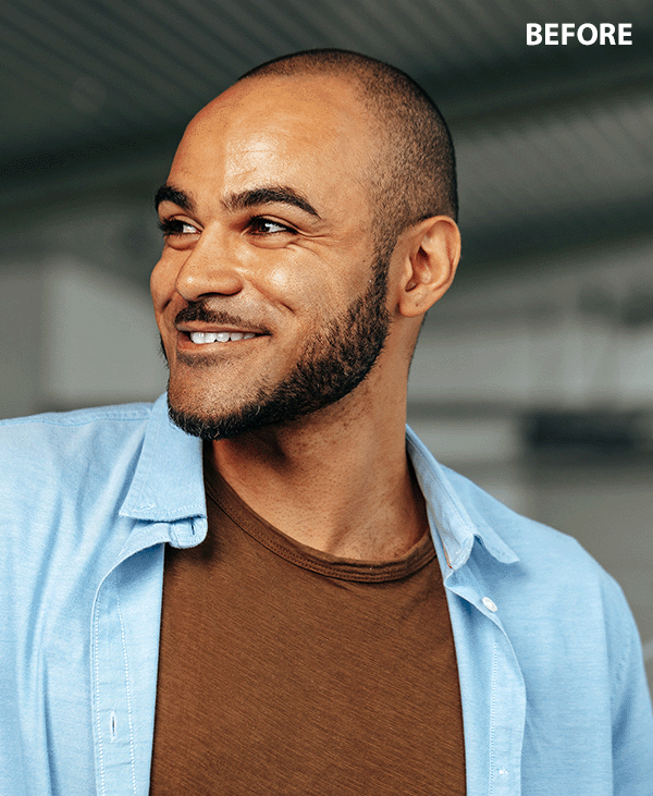 fixthephoto application to add hair to bald picture