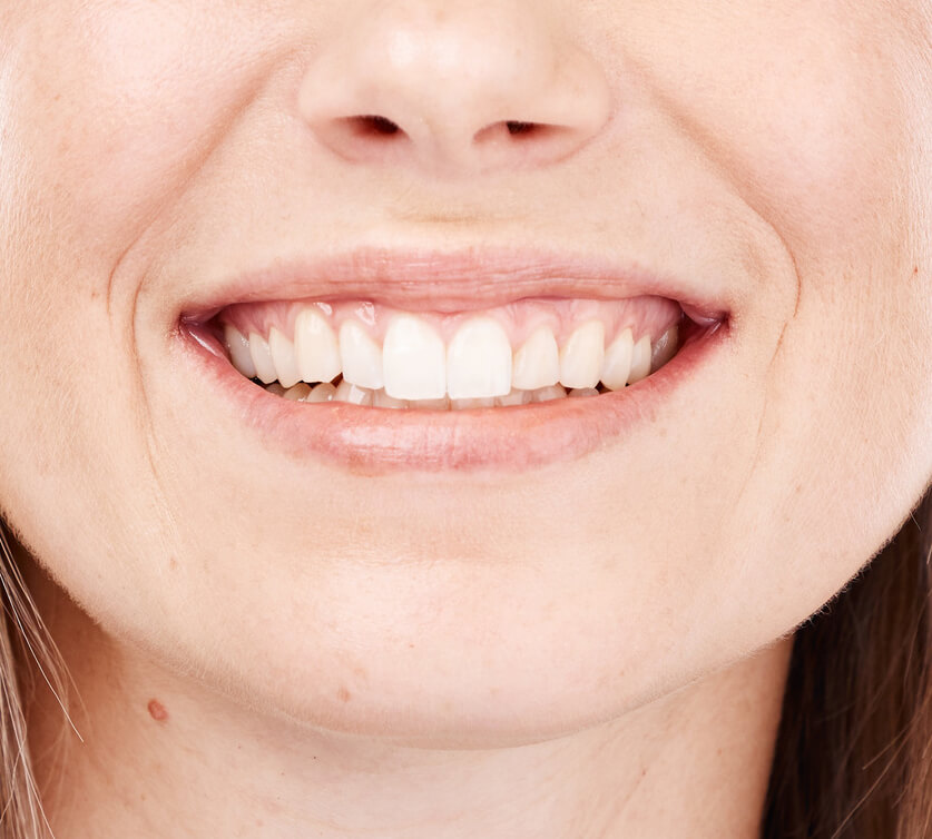 app to fix teeth in photo image