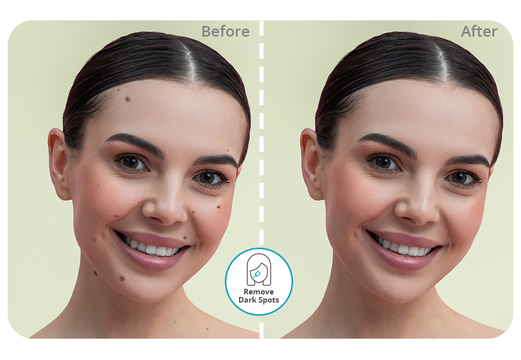 app to remove black spots cover