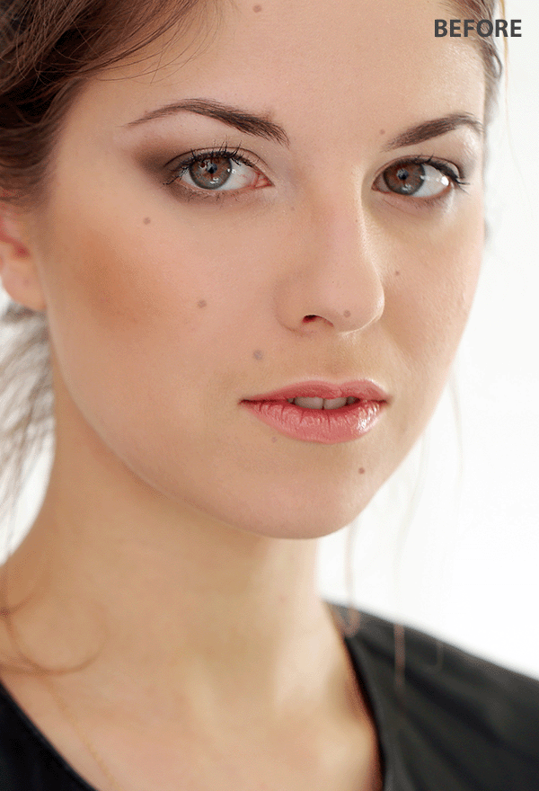 app to remove dark spots from photos