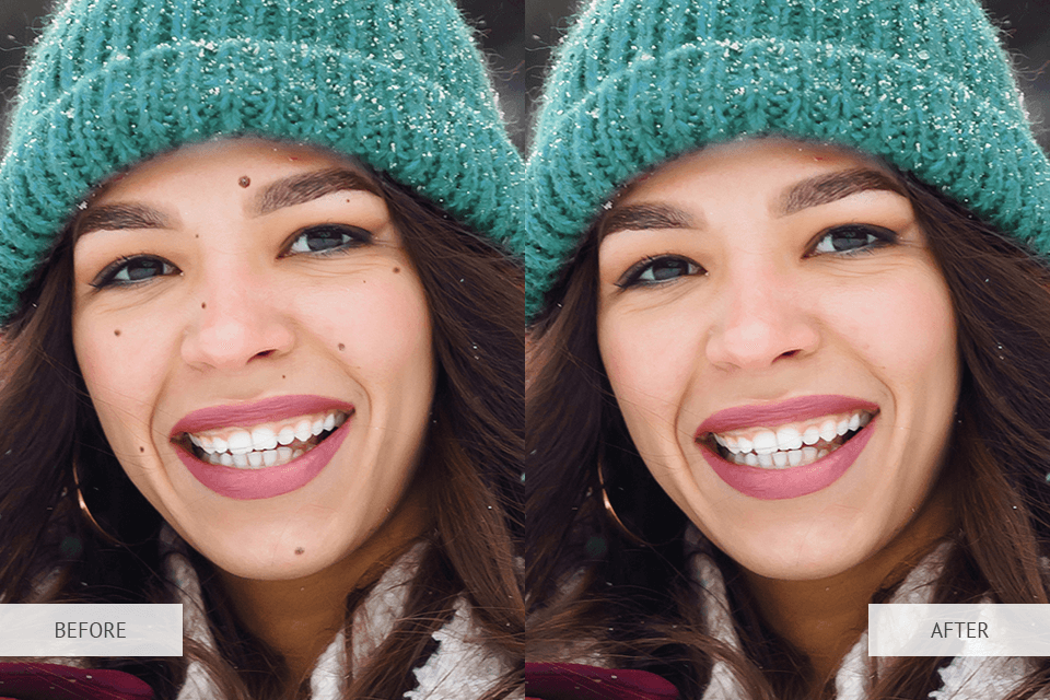 app to remove spots from face