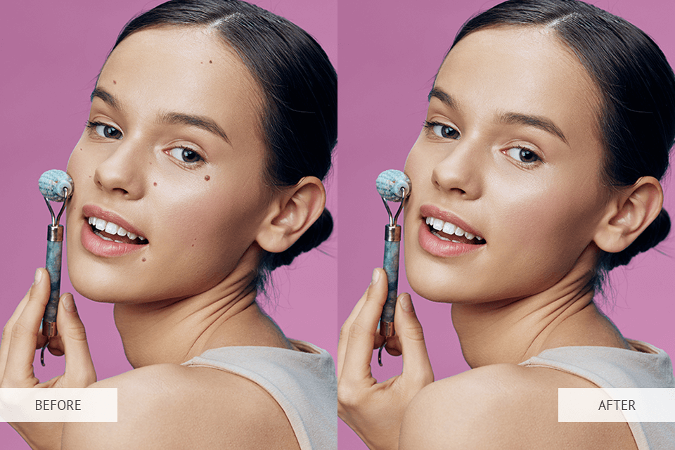 app to remove spots from photos