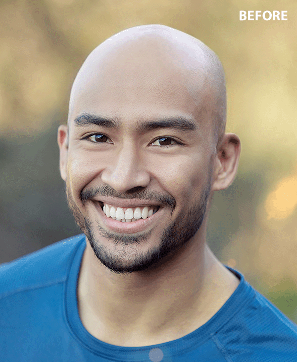 app to add hair to bald picture