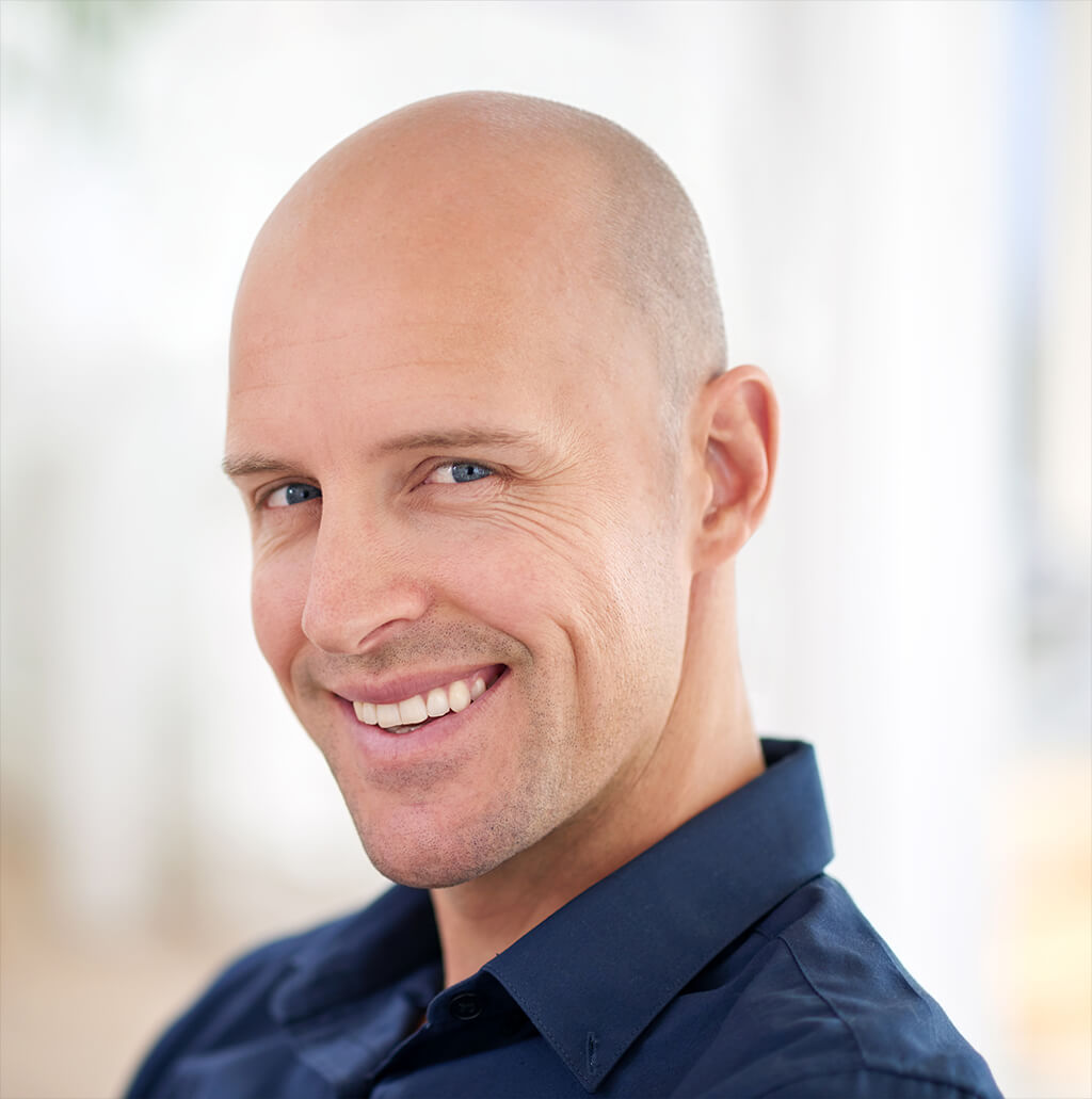 bald head filter image