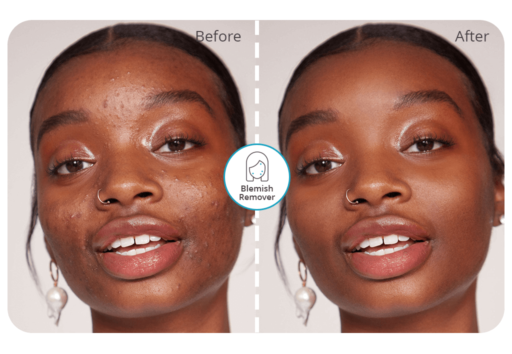 best blemish remover app cover