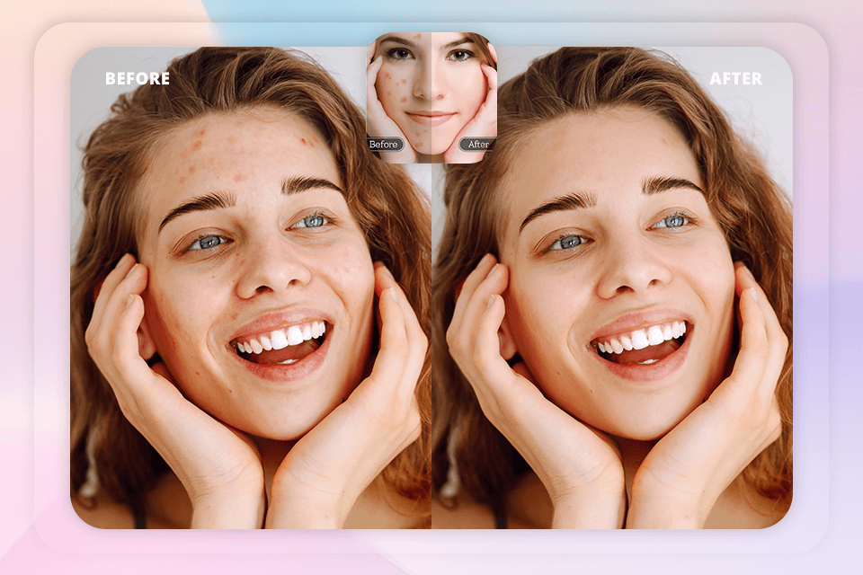 blemish remover app face blemish remover