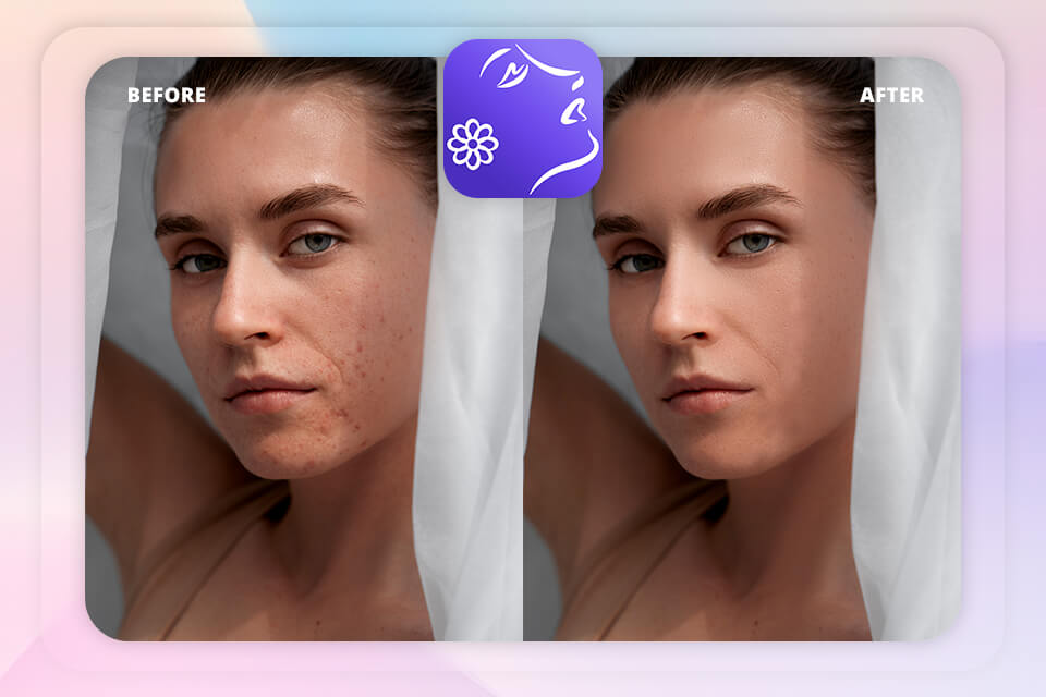 blemish remover app perfect365