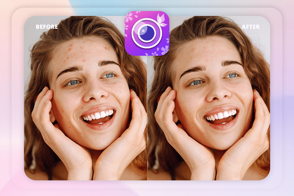 blemish remover app youcam perfect