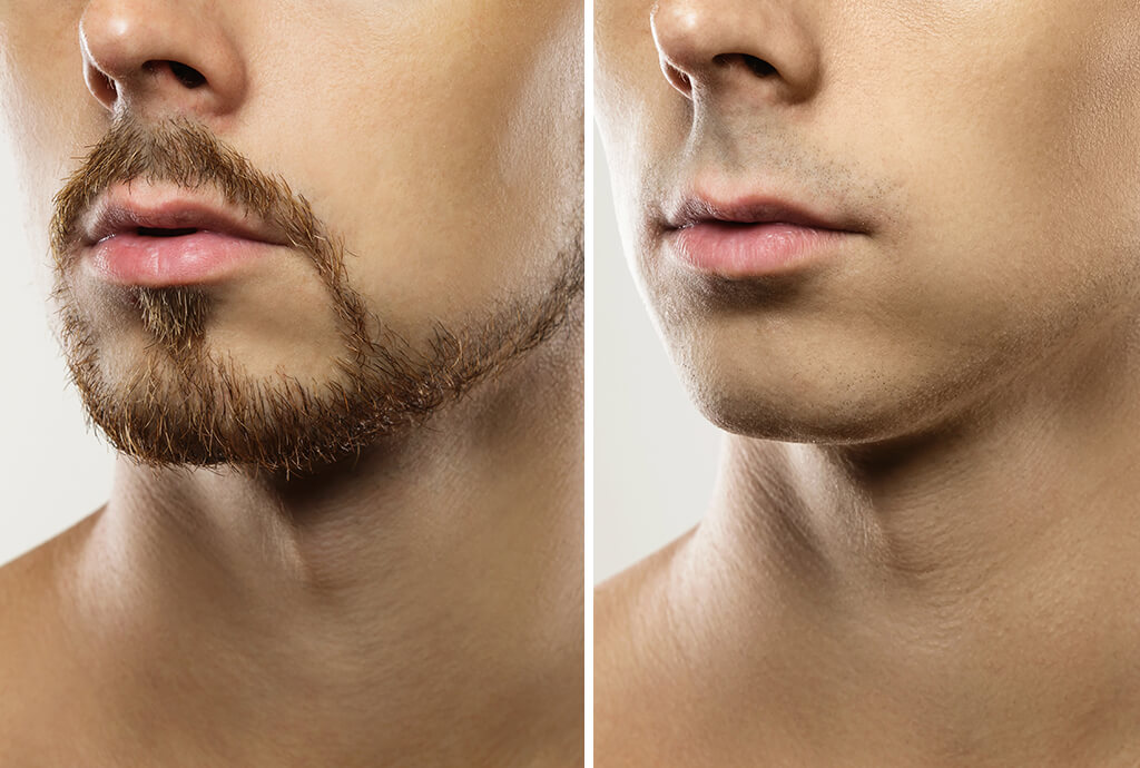 remove beard from photo