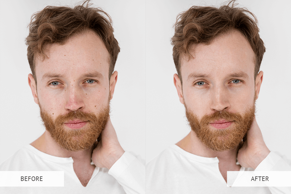 dark spot remover photo editor