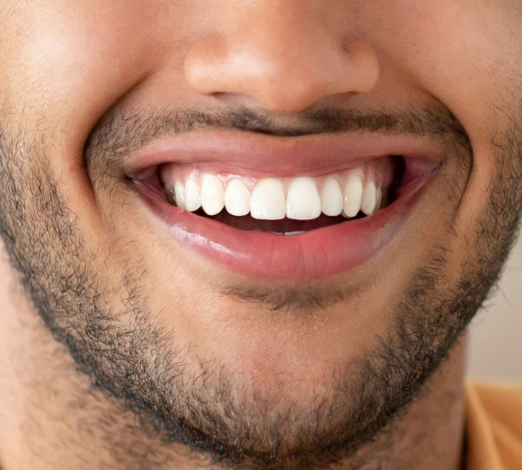 fix teeth in photo image