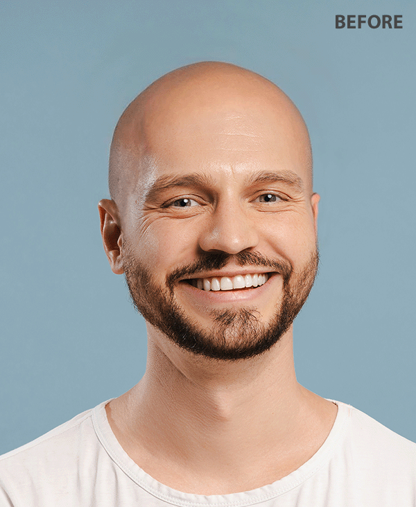 fixthephoto app to add hair to bald picture before and after