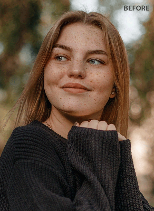 freckles app
