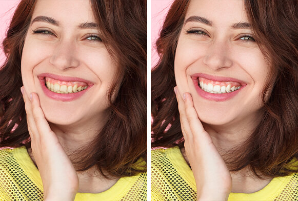 teeth whitening action photoshop download