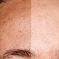 heal retouch4me photoshop panel