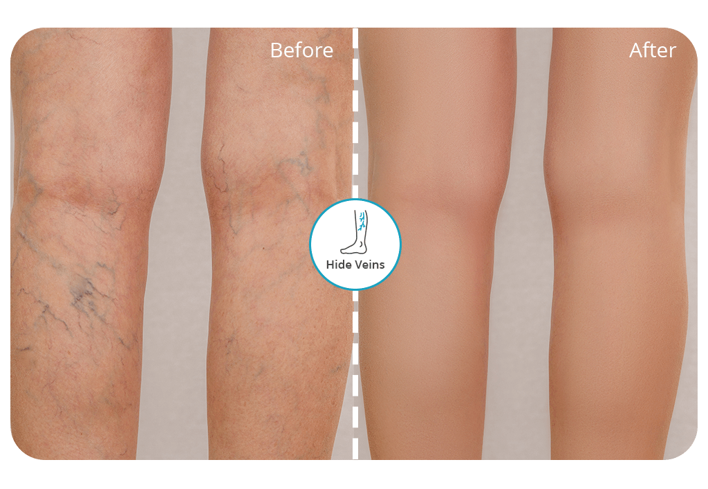 hide veins in photo cover