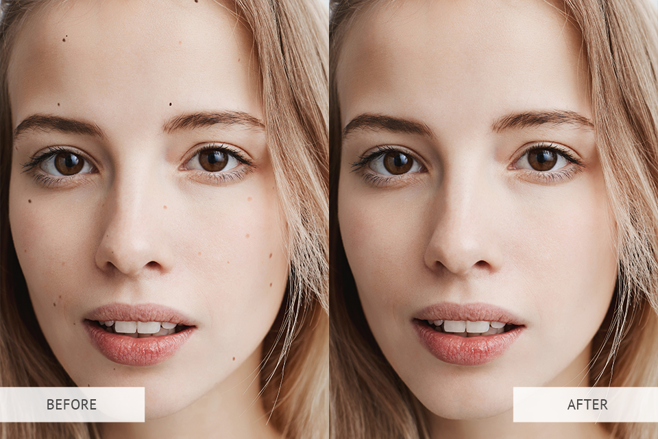 photo dark spot remover