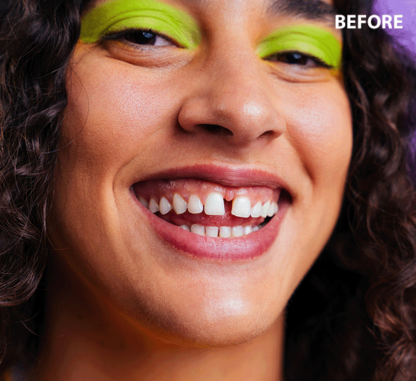 photo editor to fix teeth