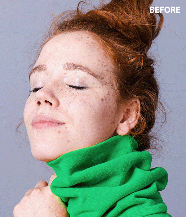 photo editor to remove spots