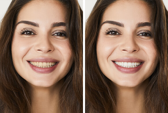 teeth whitening action photoshop download