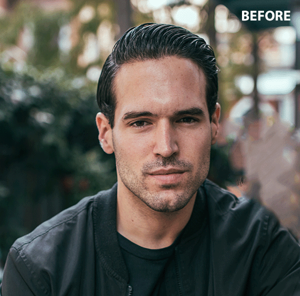 reduce forehead size app