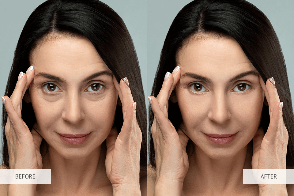 remove eye bags from photo