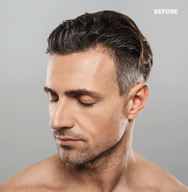 remove grey hair in photo online free